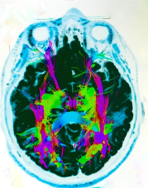 A close-up of a brain scan highlighting the areas associated with pain perception and emotional processing. Overlay the image with visualizations of neural activity.